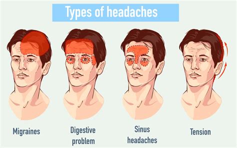 Learn symptoms, causes and pain areas with a headache location chart. . Headache worse when lying down or bending over